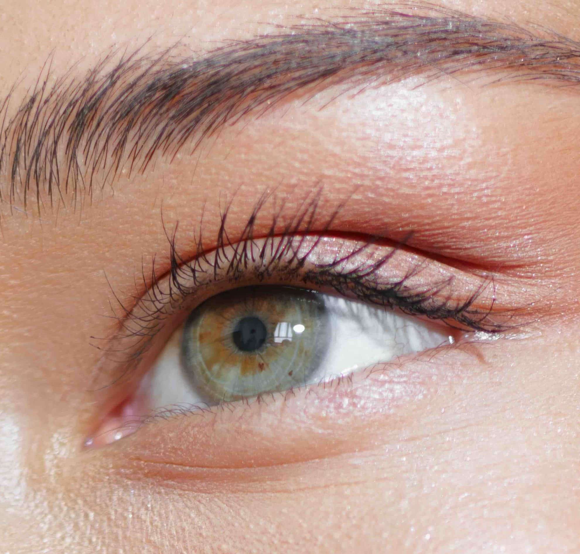 Blépharoplastie