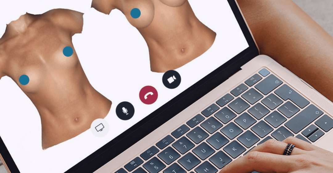 Crisalix: visualize a cosmetic surgery project for better understanding and decision-making